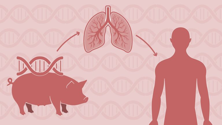 Primeiro pulmão de porco transplantado para corpo humano funciona por nove dias - Noticiário 24H