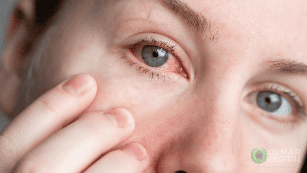 O que causa tremor nos olhos? Entenda mais sobre a condição e como tratá-la - Noticiário 24H